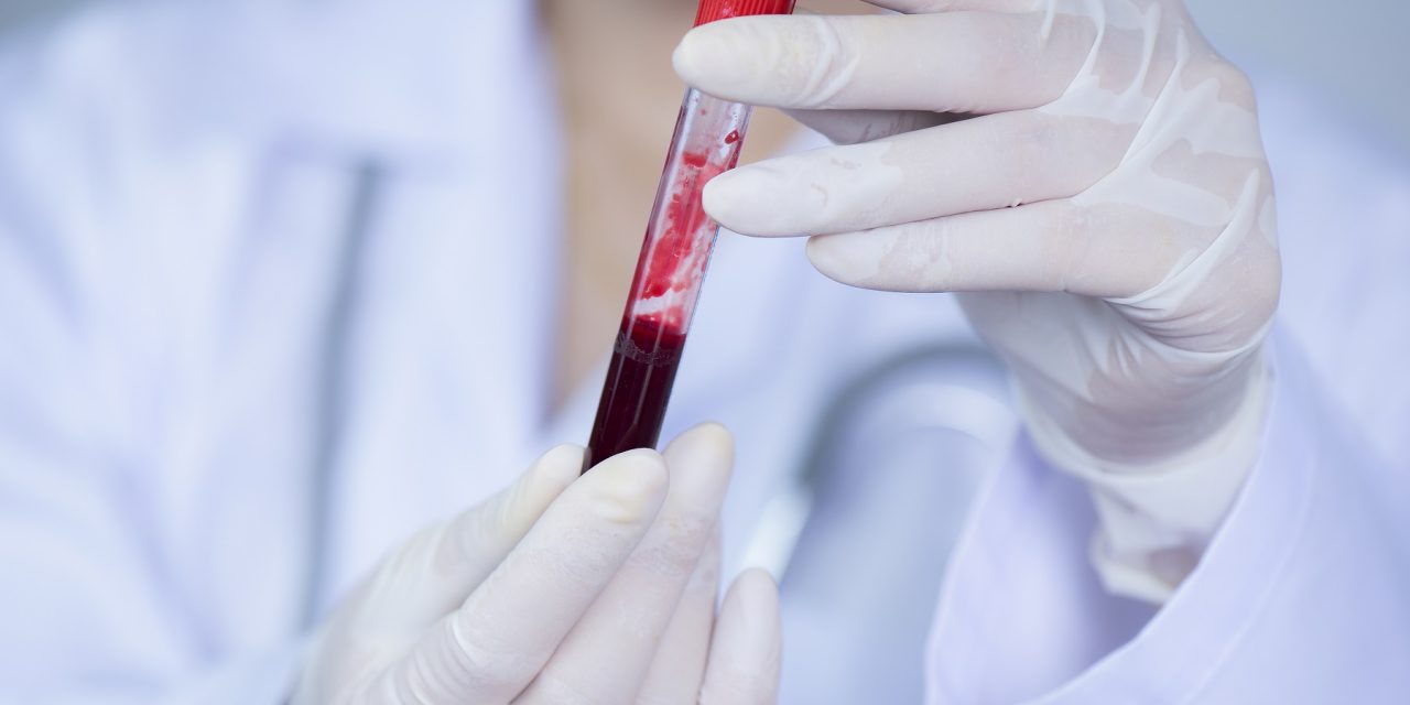 La necesidad de un análisis de sangre